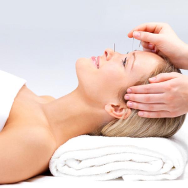 Akupunktura Będzin - Akupunktura Kosmetyczna Twarzy