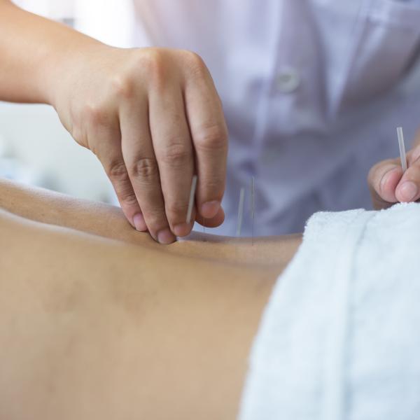 Akupunktura  Będzin- Schorzenia Układu Ruchu